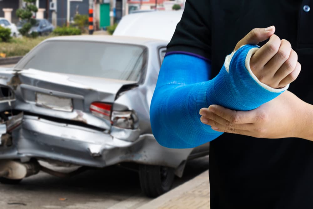 Close-up of a man with a blue bandage on his arm, representing an injury from a car accident.






